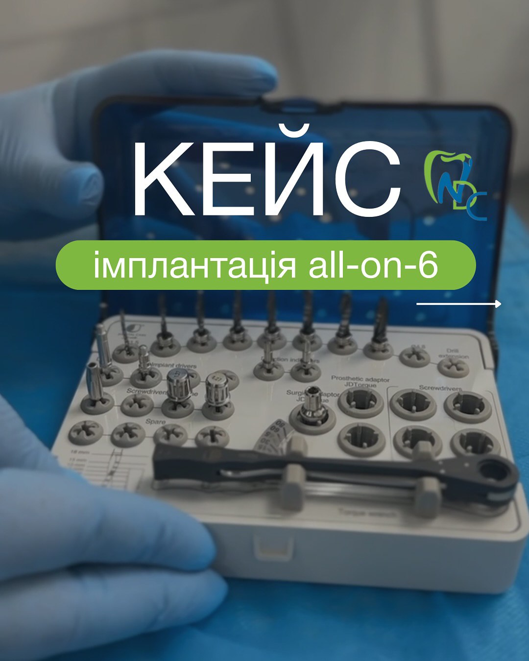 Приклад роботи - Стоматологія NDC в Києві