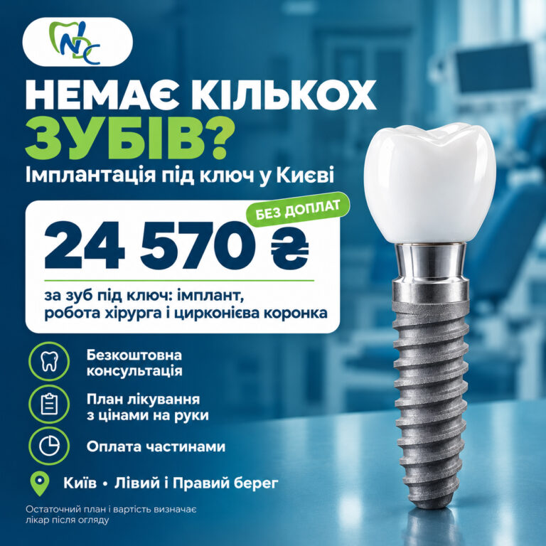 Немає кількох зубів? Імплантація під ключ — 24 570 грн за зуб 🦷